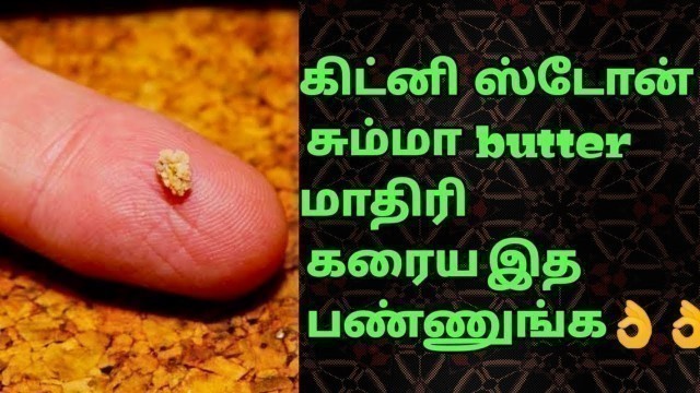 'How to cure kidney stones at home tamil | Being With Me Tamil'