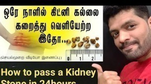 'சிறுநீரக கல் சுலபமாக கரைய எளிய வழி/Home Remedy to cure Kidney Stone in Tamil/Kidney stone treatment'