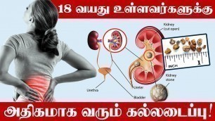 'Kidney Stone | Kidney Treatment in Tamil | Kidney Stones Symptoms | கல்லடைப்பு ஏற்படுவது எவ்வாறு?'