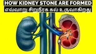 'How Kidney Stone are Formed? l kidney stone l Tamil'