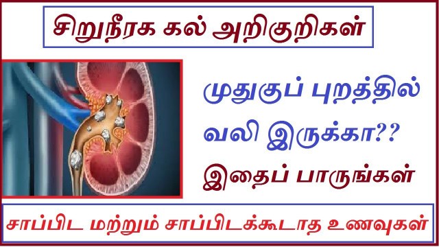 'முதுகுப் புறத்தில் வலியா? |Kidney stone symptoms in tamil|Kidney stone food to eat| iyarkai unavugal'