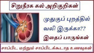 'முதுகுப் புறத்தில் வலியா? |Kidney stone symptoms in tamil|Kidney stone food to eat| iyarkai unavugal'