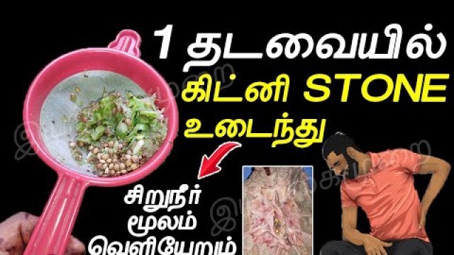 '1 நாளில் சிறுநீர் வழியா கிட்னி கல் எல்லாம் வெளியேறும் | kidney stone treatment Tamil  | கிட்னி கல்'