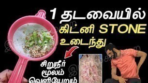 '1 நாளில் சிறுநீர் வழியா கிட்னி கல் எல்லாம் வெளியேறும் | kidney stone treatment Tamil  | கிட்னி கல்'