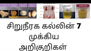 '7 symptoms of kidney stone in tamil | Joyal Health tamil'