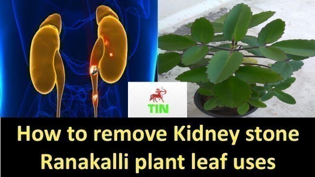 'Kidney stone treatment | kidney stones |Siruneeraga kal |Tamil info network | Ranakalli leaf uses'