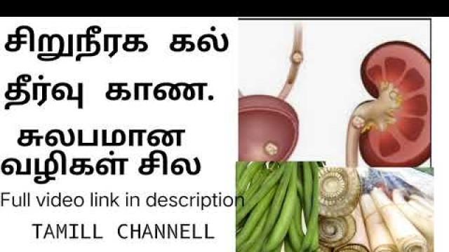 'kidney stone in tamil | medicine for kidney stone in tamil | home remedy for kidney stone in tamil |'