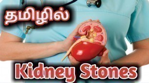 'kidney stone symptoms and treatment in tamil | kidney stone pain relief home remedies | #kidneystone'