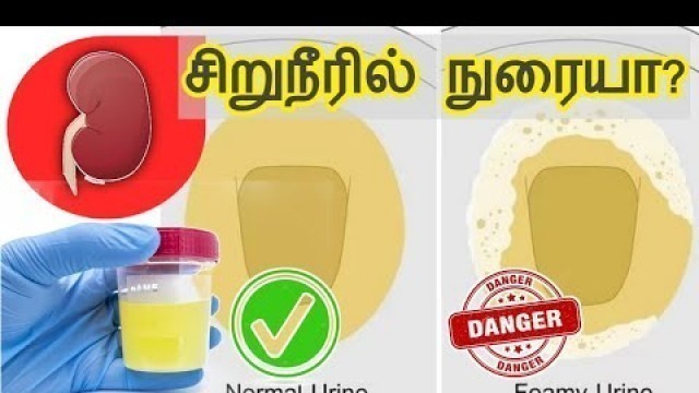 'urine foamy reason in tamil/kidney pain location on body in tamil/kidney failure symptoms in tamil'