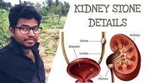 'What is Kidney Stone?? | Some tips to avoid this | Tamil | Arvind Mathiyalagan'