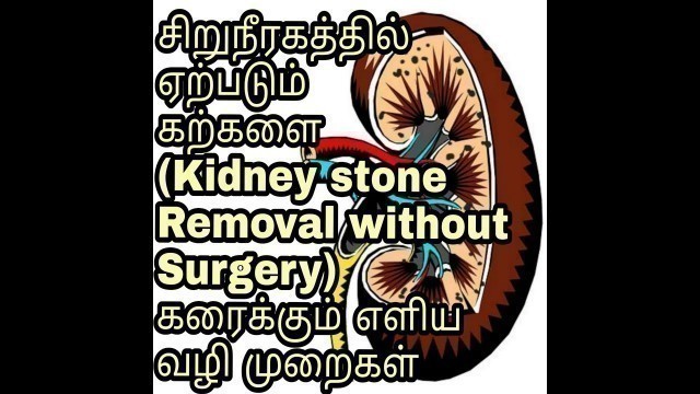 'kidney stone Symptoms, Home Remedy and diet Plan in Tamil /#Rainbowtalk'