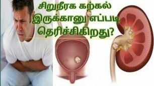 'சிறுநீரக கல் இருக்கானு தெரிஞ்சுக்கறது எப்படி? kidney stone in Tamil'