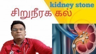 'Kidney stone ? Homeopathy tretment tamil சிறு நீரக கல்'