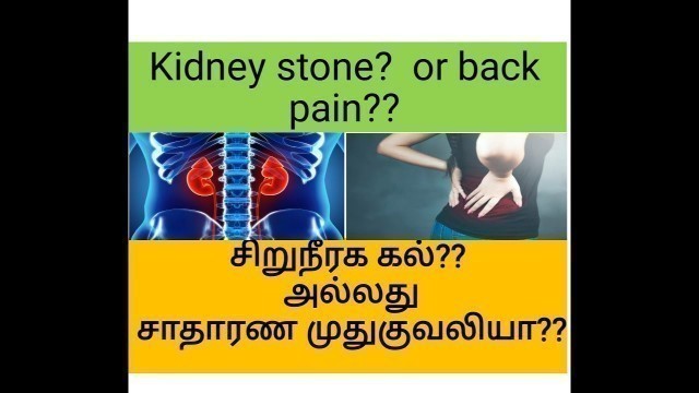 '\"சிறுநீரக கல்லா???? அல்லது இடுப்பு வலியா???\"- Kidney stone or back pain? Tamil.| By PHYSIOPRIDETAMIL'