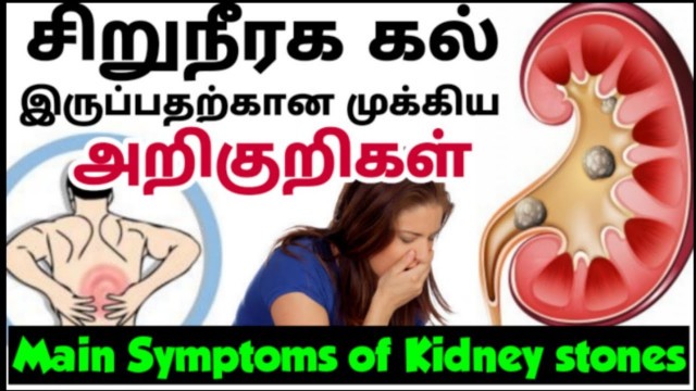 'kidney stone Symptoms in tamil| சிறுநீரக கல் அறிகுறிகள்| Symptoms of Kidney stone tamil| home remedy'