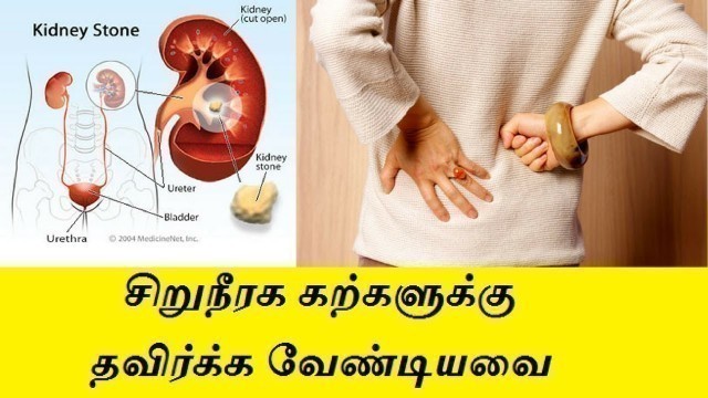 'foods to avoid for kidney stones in tamil'