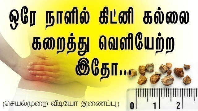 'இத  கொஞ்சம்  முயற்சி  செய்து பாருங்க.. How to pass a kidney stone in 24 hours in tamil / Tamil Nalam'