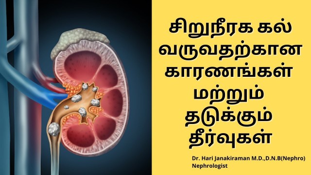 'Causes and Prevention of Kidney Stones | Tamil | Salem Gopi Hospital'