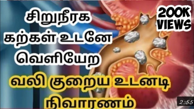 '#kidneystone/#kidneystonepain/#kidneystone home remedy/#kidney stone pain solutions in tamil'