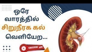 'Kidney stone treatment -Home remedies to remove kidney stones naturally in Tamil'