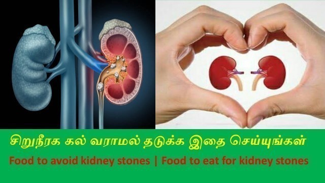 'Kidney stone | Food to avoid kidney stones |Siruneeraga kal |Tamil info network'