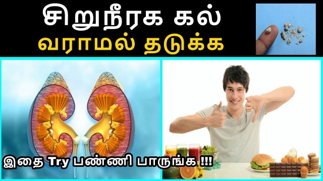 'சிறுநீரக கல் வராமல் தடுக்க சாப்பிட மற்றும் சாப்பிடக்கூடாத உணவுகள்|Kidney Stone Food to Eat and Avoid'