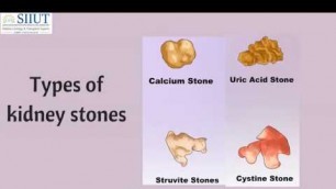 'Kidney Stone Pain Treatment In Chennai | Kidney Stone Symptoms Tamil Nadu | Urology Hospital India'