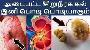 'எப்பாற்பட்ட சிறுநீரக கல்லும் எளிதில் கரைக்கலாம் | kidney stone home remedy in Tamil'