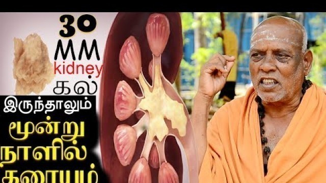 'முப்பது MM கிட்னி கல் இருந்தாலும் மூன்றே நாளில் கரையும் || KIDNEY STONE IN TAMIL || KAYAKALLPAM TV'