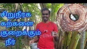 'How to removal kidney stones naturally | சிறுநீரக கற்களை போக்கும் அற்புத நீர் | Tamil Tamizha'