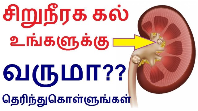 'சிறுநீரக கல் உங்களுக்கு வருமா தெரிந்துகொள்ளுங்கள் | Kidney stone in Tamil'