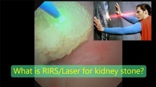 'Latest laser treatment for kidney stone - Tamil (சிறுநீரக கற்களுக்கு நவீன லேசர் சிகிச்சை) Dr.Raguram'