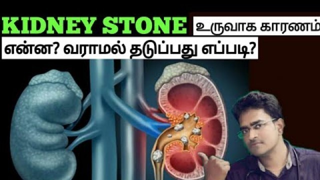 'Kidney stone causes& treatment in tamil/medical awareness in tamil'