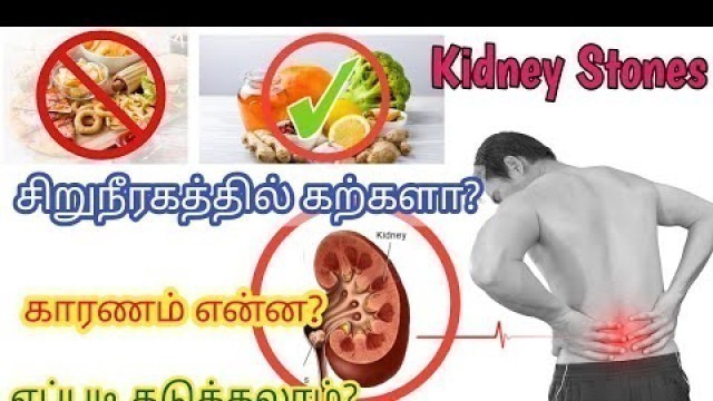 'kidney stone treatment in tamil/kidney stone treatment in tamil food/kidney stone symptoms in tamil'