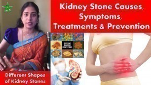 'Kidney Stone Causes, Symptoms, Treatments & Prevention in Tamil | Asha Lenin'