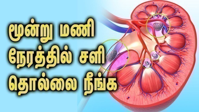 'Symptoms of kidney stone problem - Tamil Health Tips'