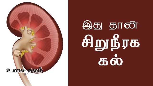 'kidney stone symptoms  | kidney stone symptoms in tamil | kidney stone pain Tamil'