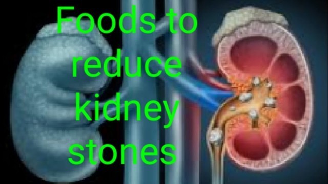 'Best 10 foods to reduce kidney stones in Tamil'