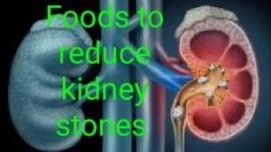 'Best 10 foods to reduce kidney stones in Tamil'