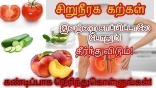 'Kidney stone treatment in Tamil | kidney stone pain Tamil | Kidney stone in Tamil | STAR LABORATORY'