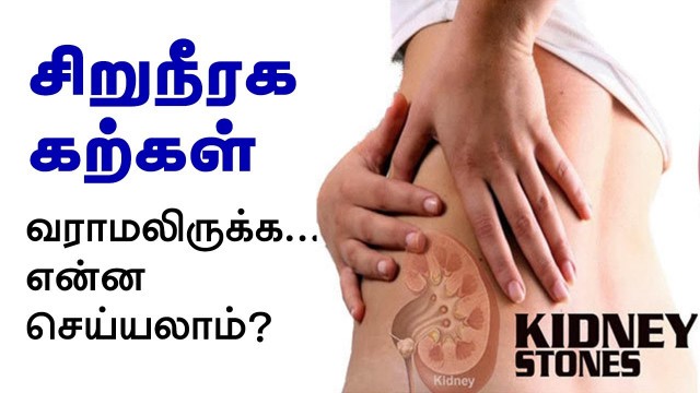 'Kidney Stones - How to Prevent Kidney Stones Naturally?'