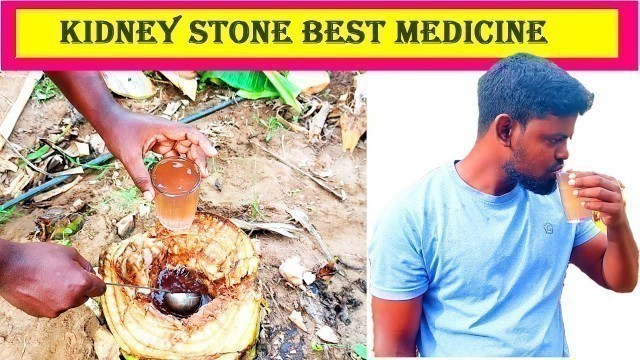 'Banana Stem Juice|Live Extraction | Best medicine for Kidney Stone | Village Cooking Stupid'