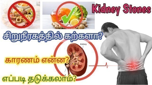 'Kidney stone symptoms in Tamil | kidney stones remedies in Tamil | kidney stones in Tamil | kidney'