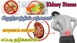 'Kidney stone symptoms in Tamil | kidney stones remedies in Tamil | kidney stones in Tamil | kidney'