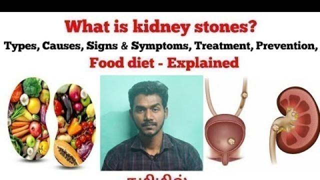 'Kidney Stones | அறிகுறிகள் | Causes | Symptoms | Food diet | தவிர்ப்பது எப்படி? | Prevention | Tamil'