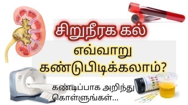 'Kidney stone treatment in Tamil | kidney stone symptoms in Tamil | kidney stone pain Tamil'