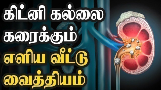 'கிட்னி கல்லை கரைப்பது எப்படி? kidney stone avoid food in tamil'