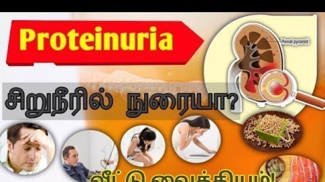 'Proteinuria treatment in Tamil/foamy reason in tamil/kidney pain location on body in tamil/urine'