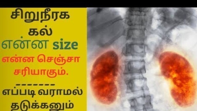 'kidney disease symptoms in tamil | kidney stone treatment in tamil'