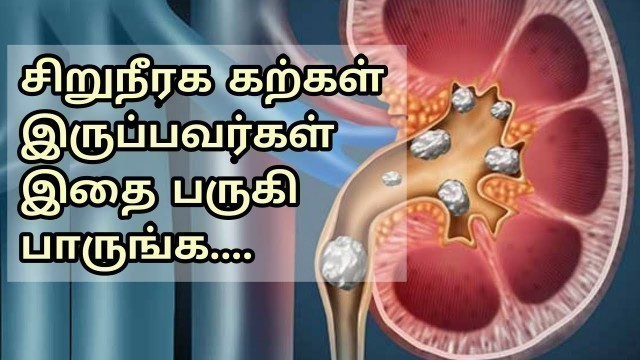 'சிறுநீரக கற்கள் கரைய | Kidney stone Treatment at Home in Tamil | Home Remedy Tips'